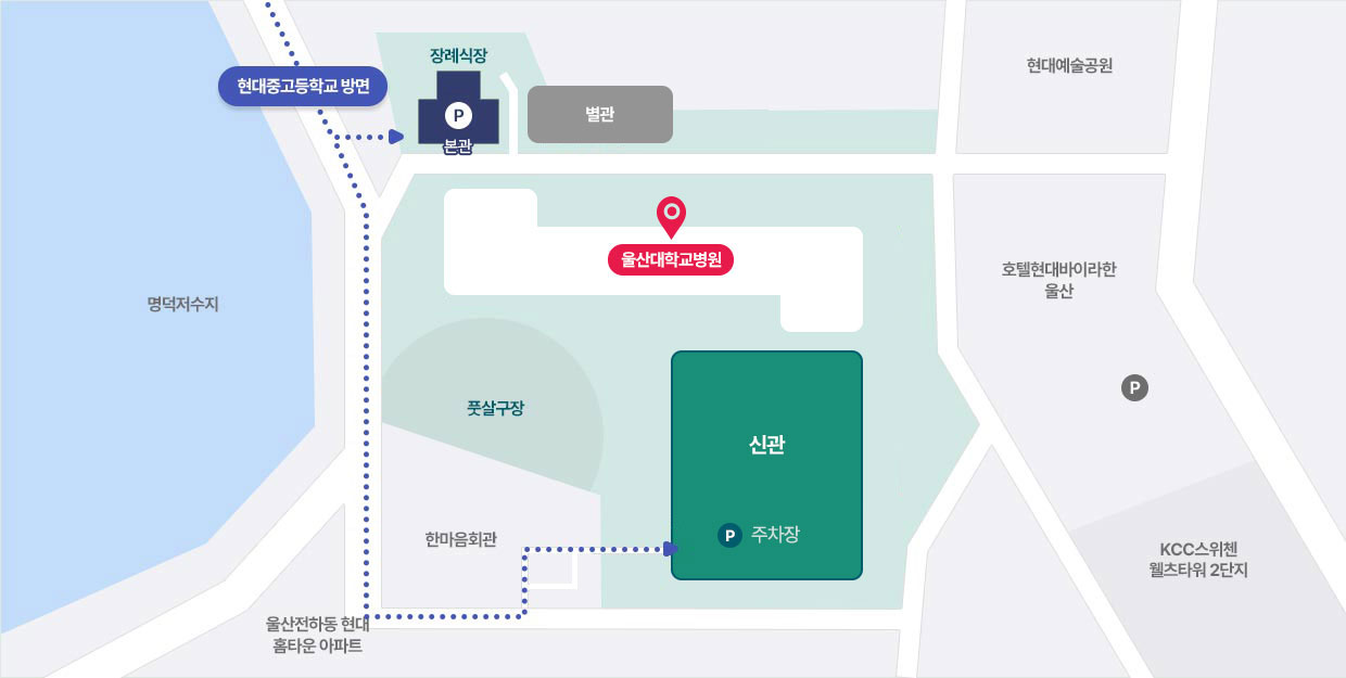 현대중고등학교 방면에서 울산대학교병원 주차장 안내 지도로 자세한 내용은 아래 참조