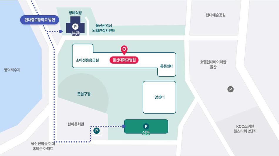 현대중고등학교 방면에서 울산대학교병원 주차장 안내 지도로 자세한 내용은 아래 참조