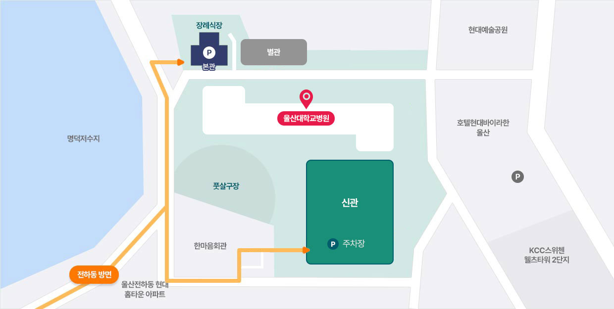 전하동 방면에서 울산대학교병원 주차장 안내 지도로 자세한 내용은 아래 참조