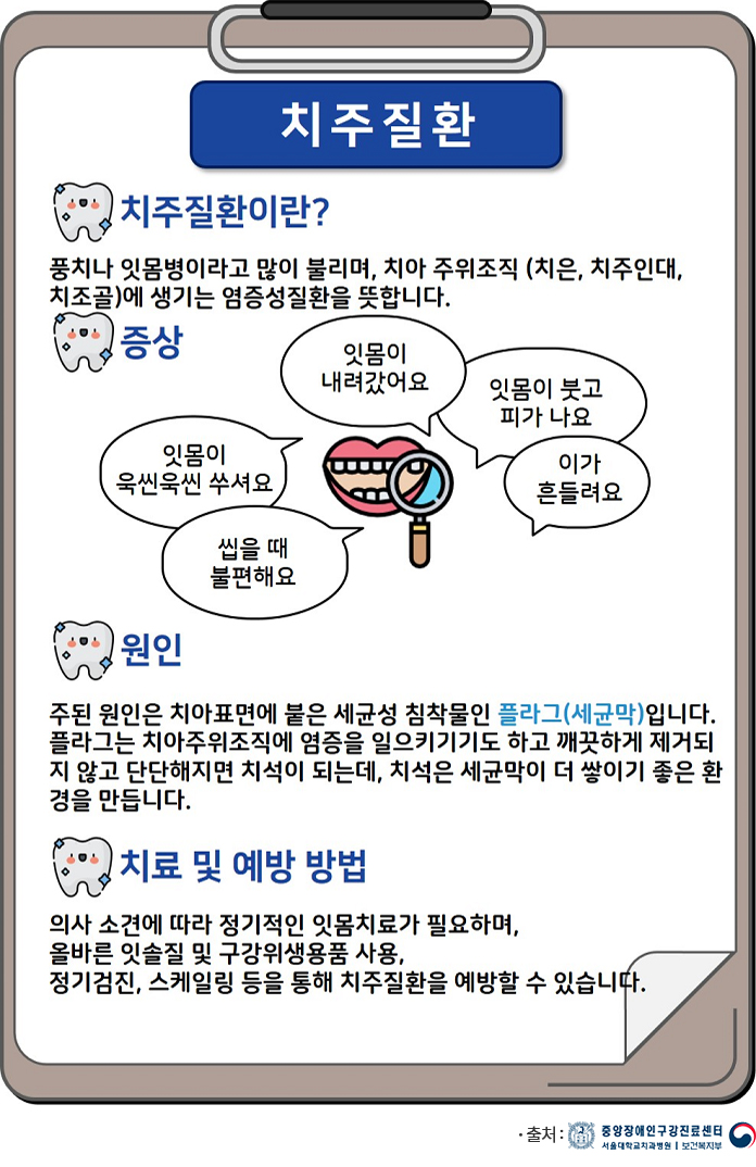 구강건강상식 치주질환
