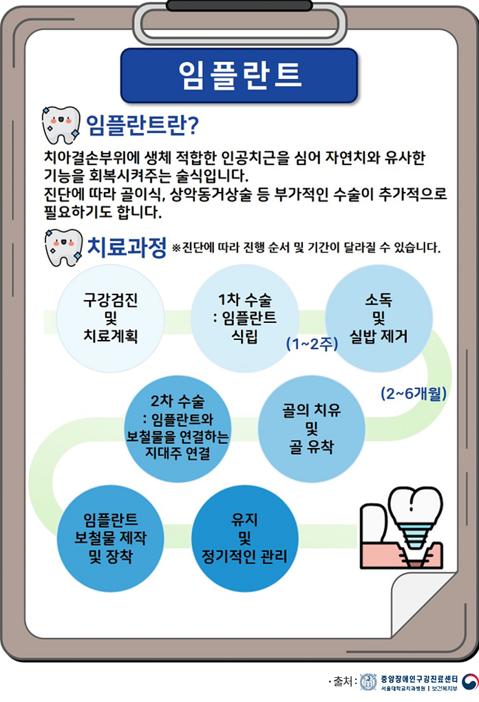 구강건강상식 임플란트