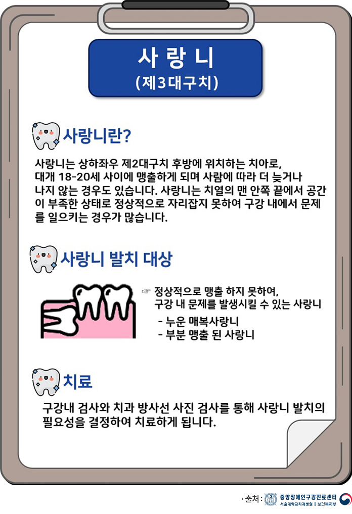 구강건강상식 사랑니