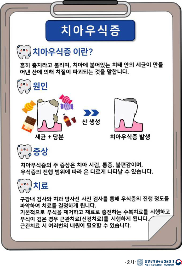 구강건강상식 치아우식증