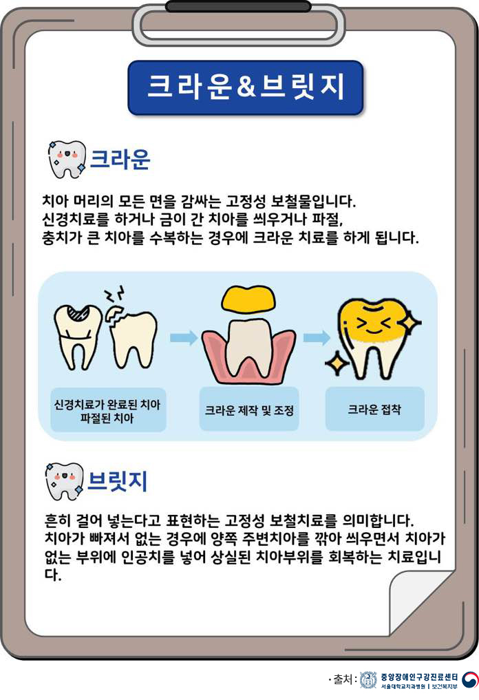구강건강상식 크라운 및 브릿지