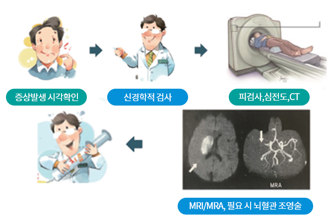 뇌경색 진단 이미지